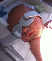 Simon pendant sa jaunisse