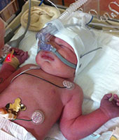 Simon aux soins intensifs